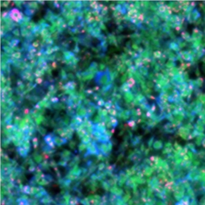 MiROM micrograph of living adipocytes (1 mm × 1 mm): lipids (red), proteins (green) and carbohydrates (blue). © Helmholtz Zentrum München/Miguel A. Pleitez