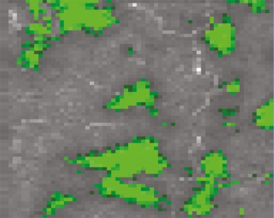 The digitally produced image illustrates how biochemical changes in the pancreas may be studied with the described method, without the need for labelling with external markers. The green structures correspond to an accumulation of beta-sheet proteins which indicate the development of type 2 diabetes. Image:Ulf Ahlgren