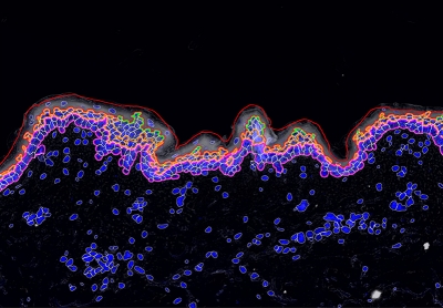 Tracking down the mechanisms of skin ageing. Launch of new Christian Doppler Laboratory involving MedUni Vienna, University of Natural Resources and Applied Life Sciences Vienna, Vienna University of Technology and commercial partner Chanel