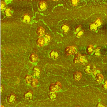 A composite image of herpes simplex virus particles, obtained by AFM-IR. Courtesy of Dmitry Kurouski
